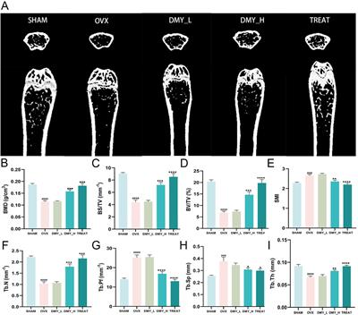 Dihydromyricetin ameliorate postmenopausal osteoporosis in ovariectomized mice: Integrative microbiomic and metabolomic analysis